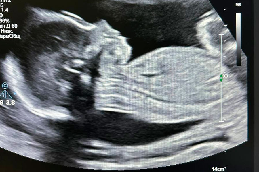 РНЦП операция