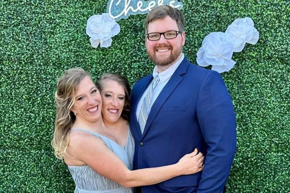 Сиамские близнецы 2.jpg