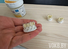 Впервые пациенту в Беларуси установили самый большой аортальный клапан через миллиметровые проколы