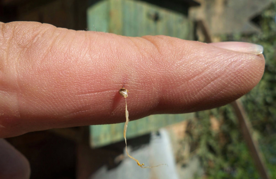 Жало пчелы в коже человека