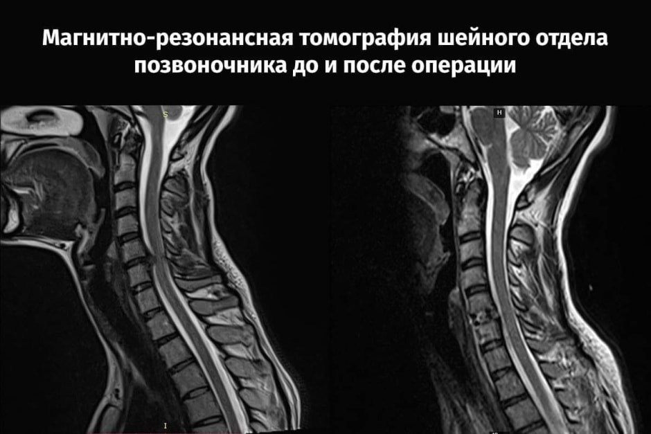 шея1.jpg шея1.jpg