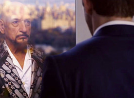 Отец рано облысел – значит, и я тоже? Рассказываем, как “передается” по наследству риск ранней потери волос