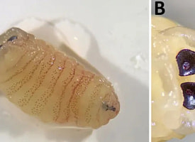 Женщина чихала “глистами” из носа: врачи описали крайне редкое заражение личинками 