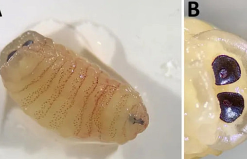 Женщина чихала “глистами” из носа: врачи описали крайне редкое заражение личинками 