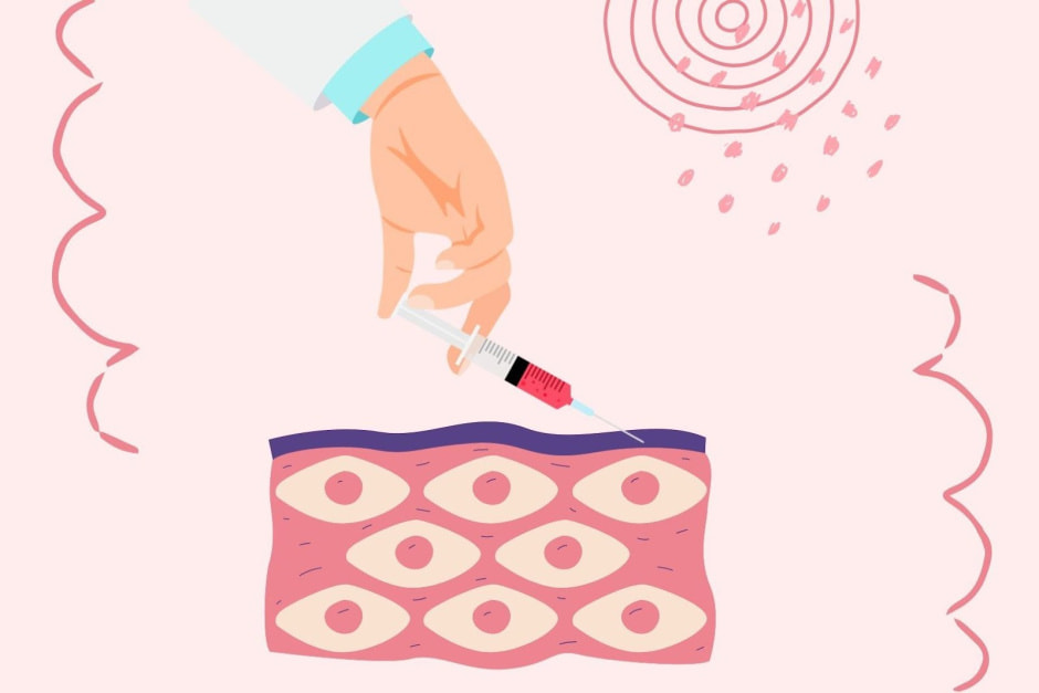 Интимное омоложение 6.jpg Интимное омоложение 6.jpg