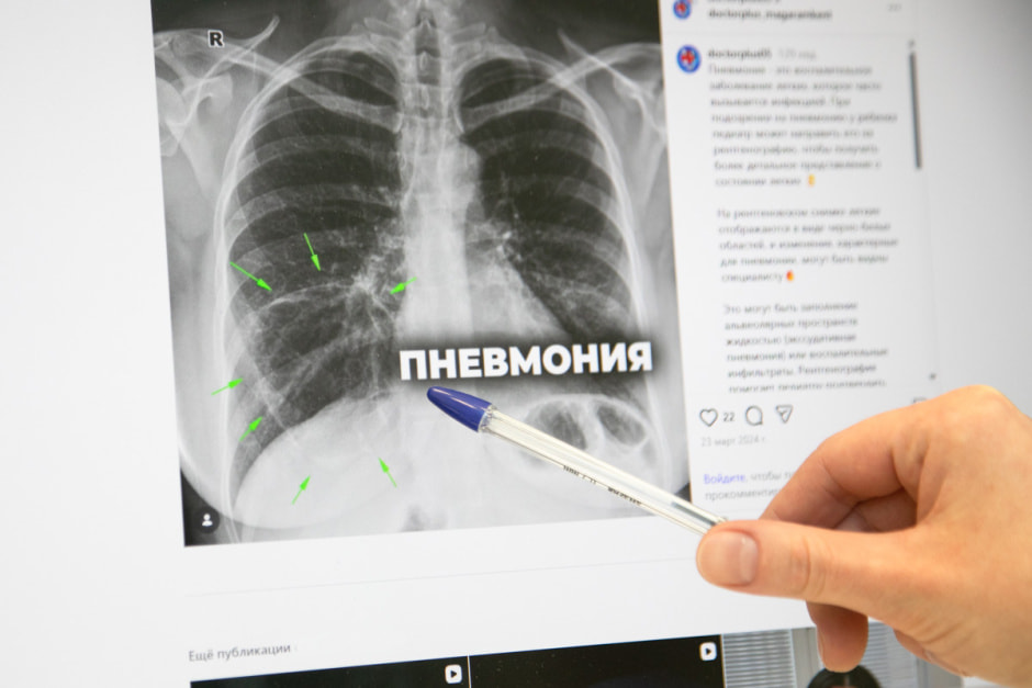 Рентген легких