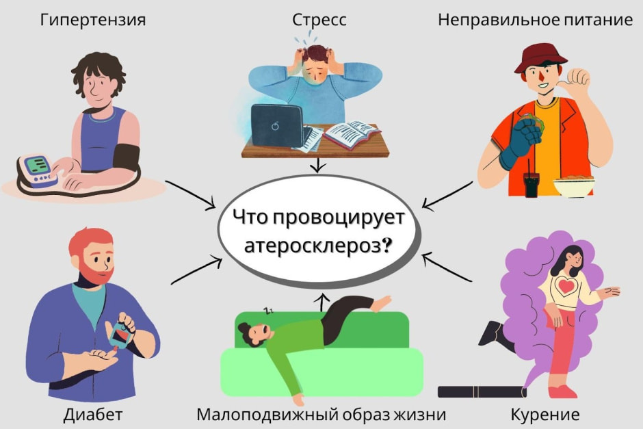 Атеросклероз 3.jpg