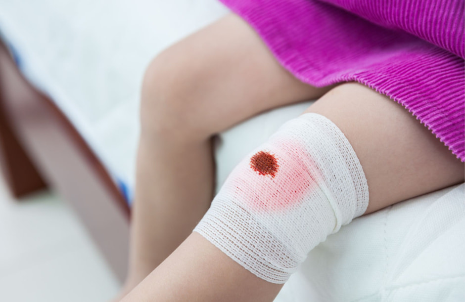 Бинтовая повязка