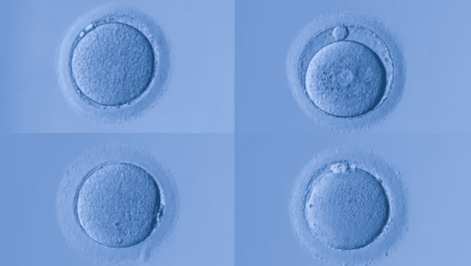Коллаж из женских яйцеклеток