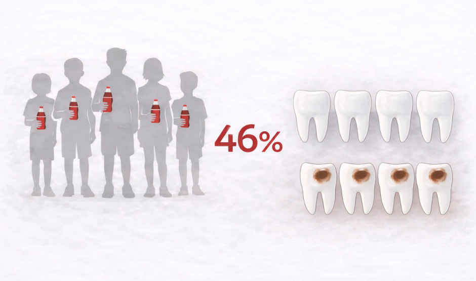 Дети и кариес