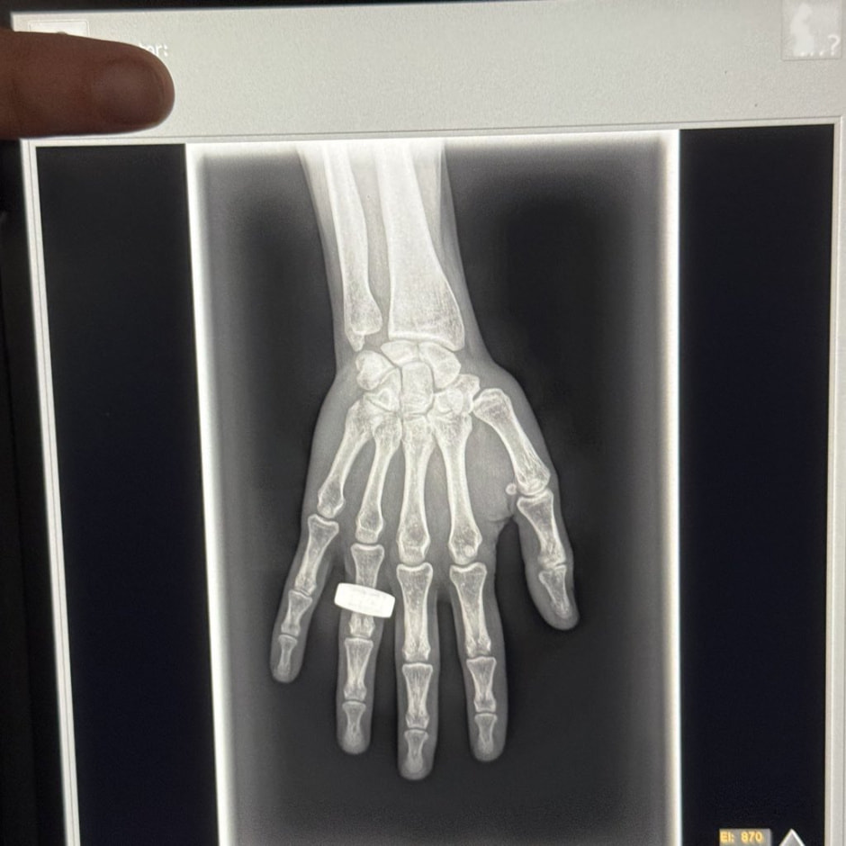 рентгеновский снимок в космосе.jpeg