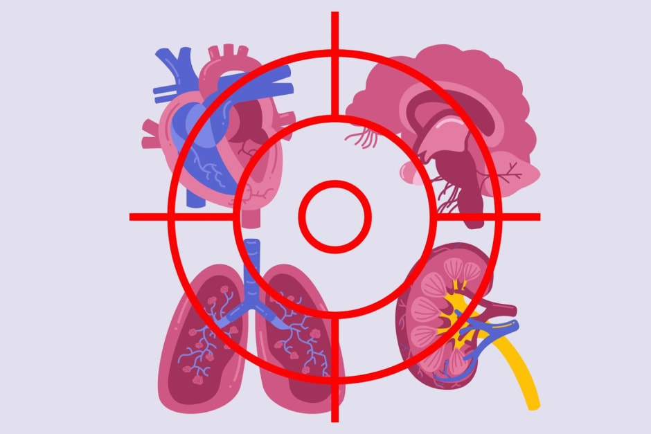 Тромбоз 3.jpg