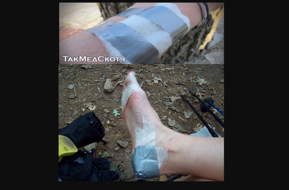 скотч медицинский армированный скотч медицинский армированный