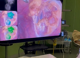 Использовали “светящуюся навигацию”. Ребенку с опухолью провели уникальную операцию в Беларуси 