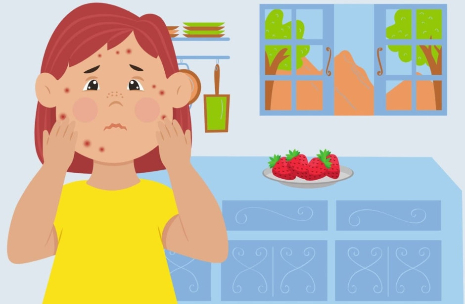 Аллергия на клубнику.jpg