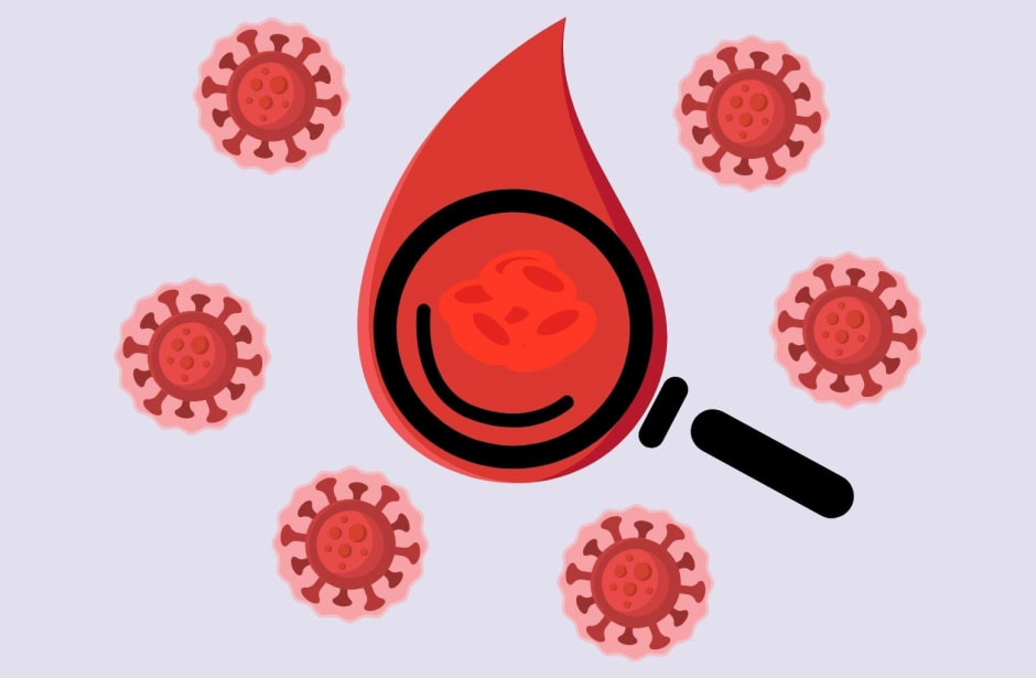 Тромбоз 4.jpg