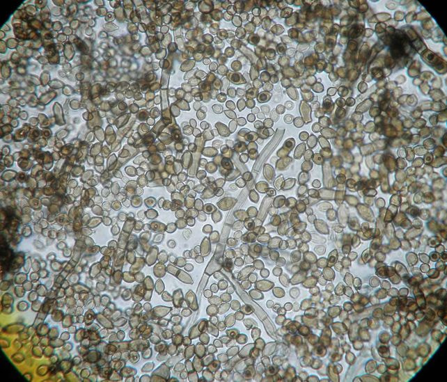 Гриб под микроскопом