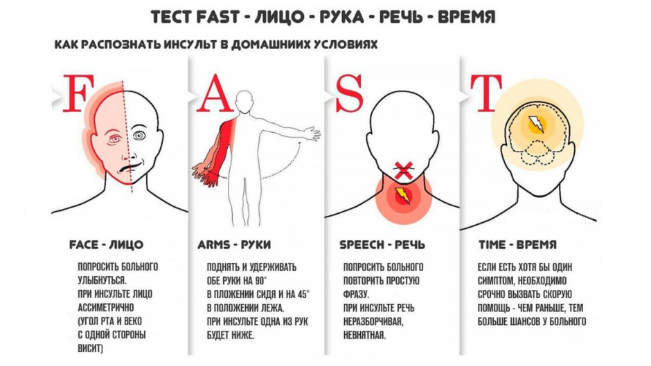 Инсульт фаст.jpg