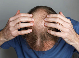 Облысению конец? Тысячелетнее растение из Китая привлекло внимание учёных