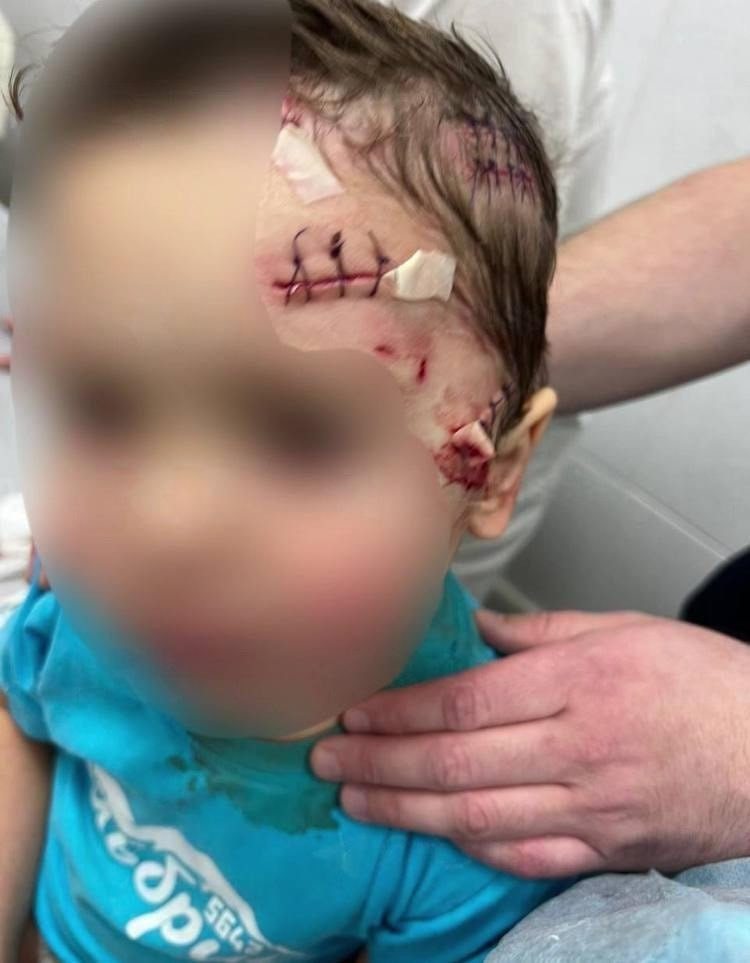 Пантера покусала трехлетнего ребенка в передвижном цирке в Ангарске.jpg