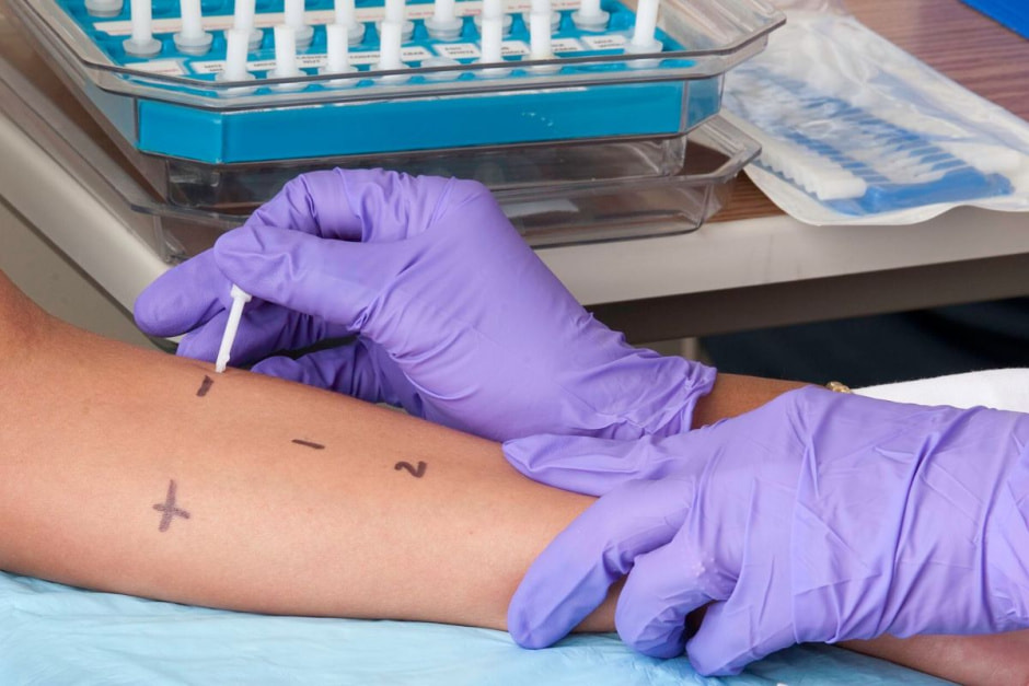 Кожные тесты на аллергию