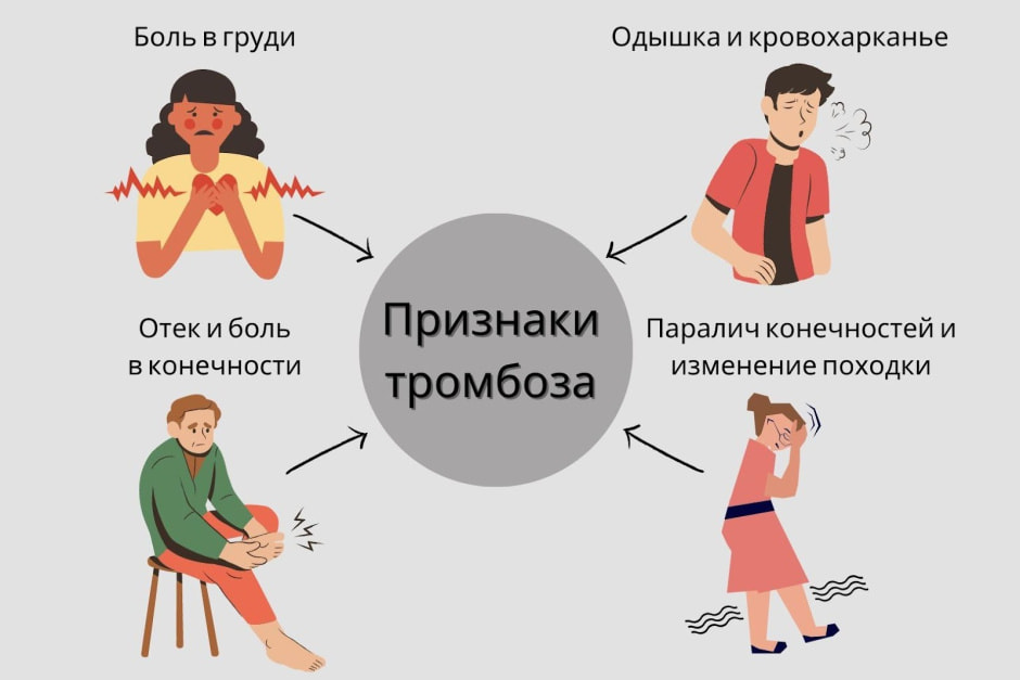 Тромбоз 6.jpg