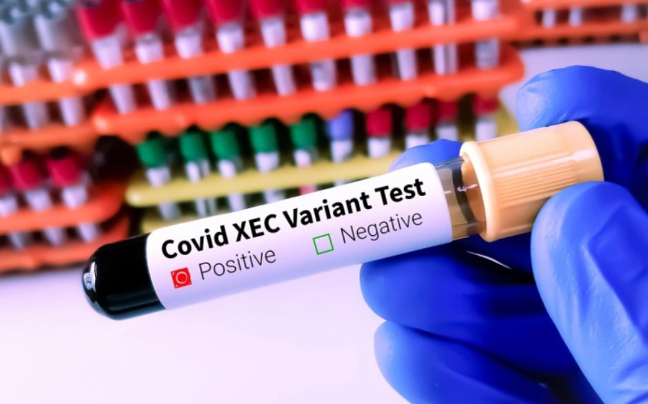 Новый вид коронавируса .jpg