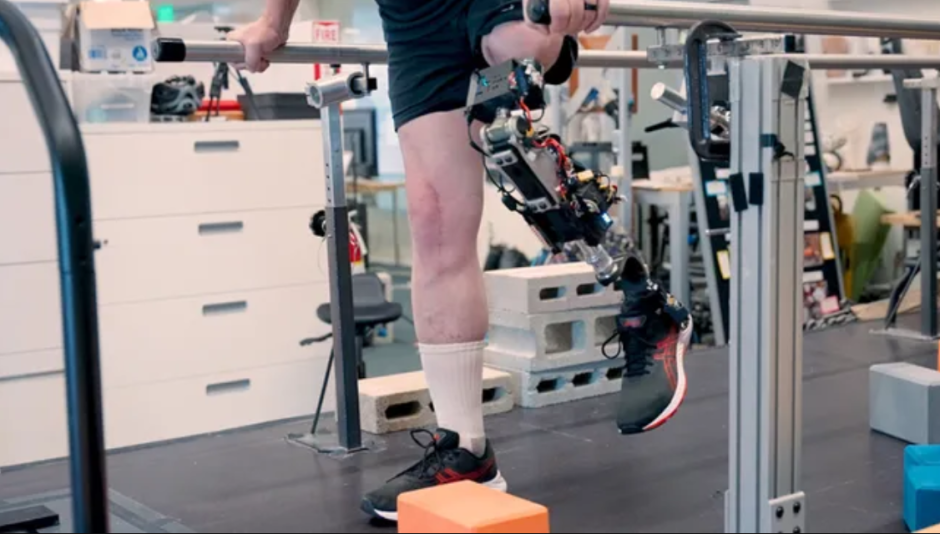 бионический протез