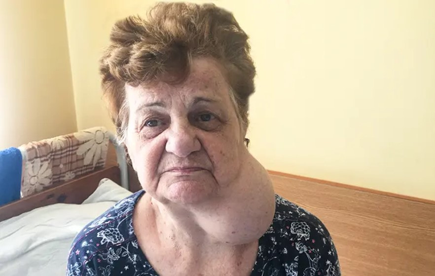 Аневризма 1.jpg