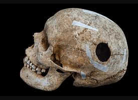 В Англии обнаружили массовое захоронение эпохи викингов с обезглавленными телами и “великаном” после трепанации мозга