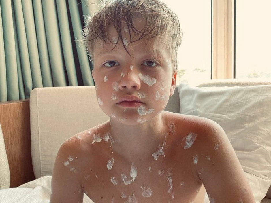 Ветрянка 7.jpg Ветрянка 7.jpg