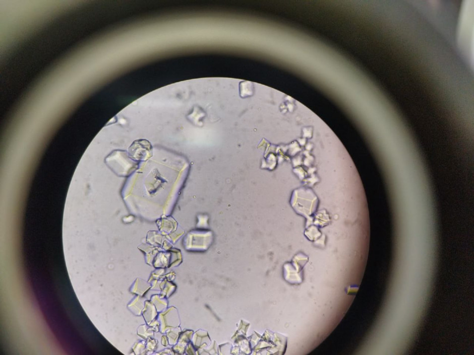 Струвиты под микроскопом