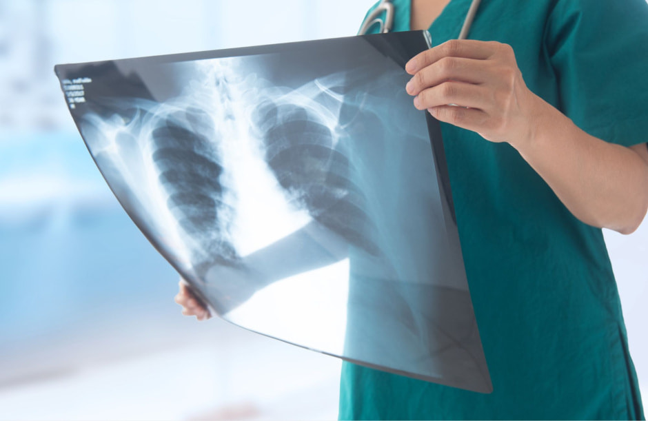 рентген.jpg рентген.jpg