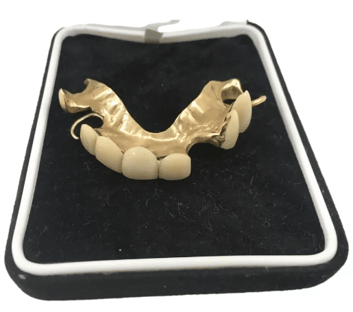 Зубной протез Черчилля.PNG