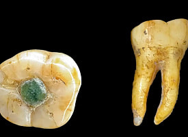 В цивилизации Майя ставили “пломбы” из драгоценных камней: археологи нашли неожиданные доказательства 