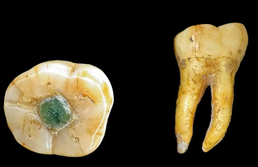 В цивилизации Майя ставили “пломбы” из драгоценных камней: археологи нашли неожиданные доказательства 