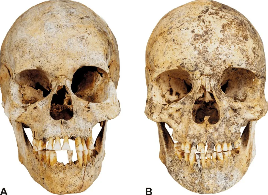 Сестры из неолита Сестры из неолита