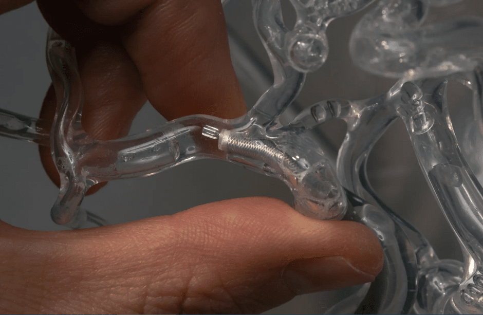 милли-спиннер