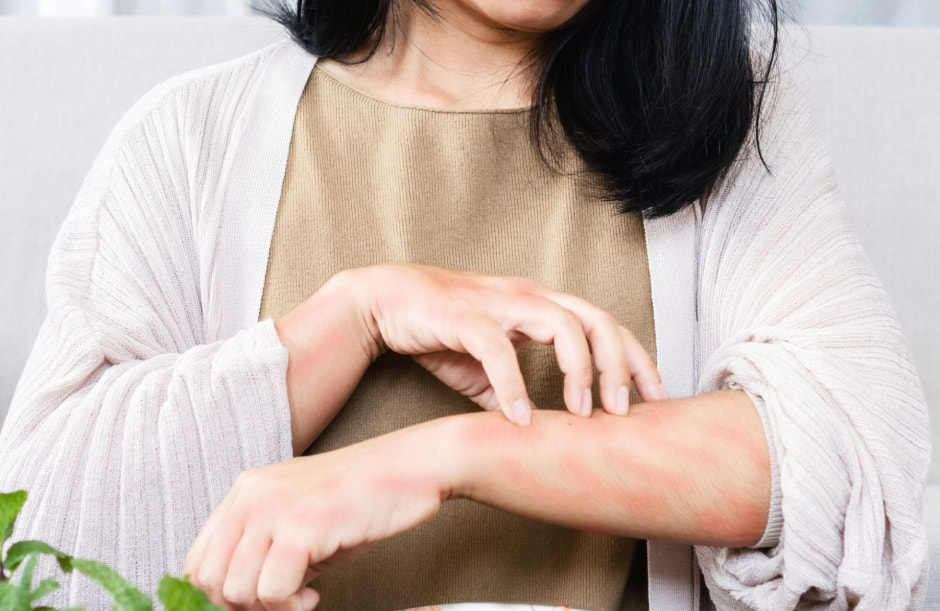 Псевдоаллергия на клубнику 4.jpg