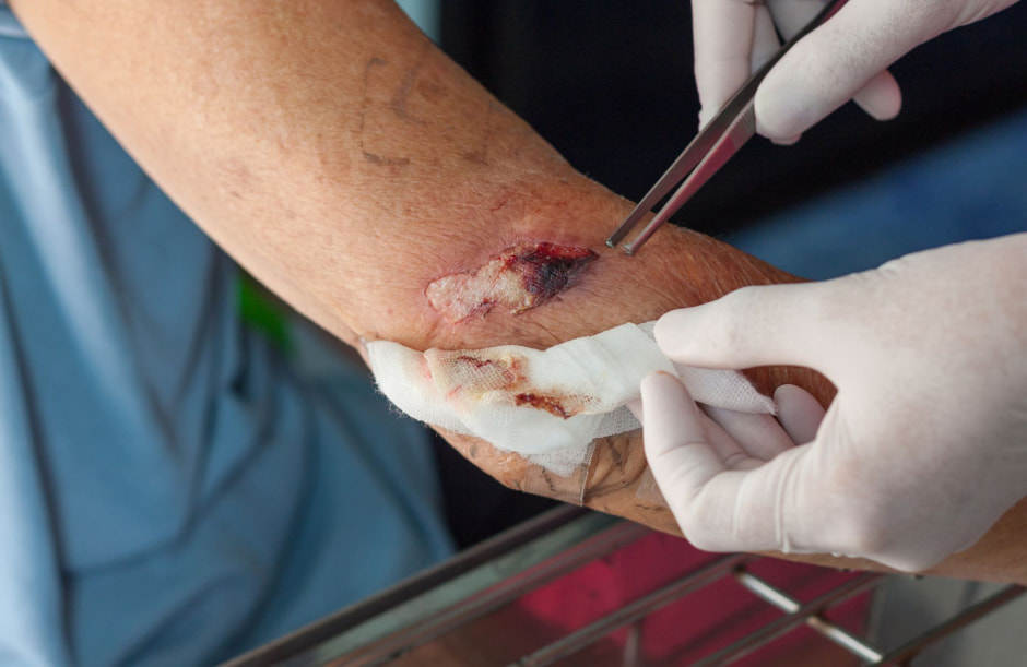 Летом раны чаще воспаляются.jpg