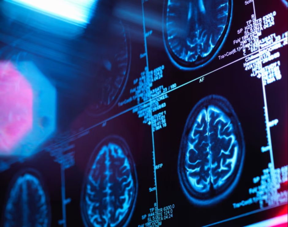 развитие мозга