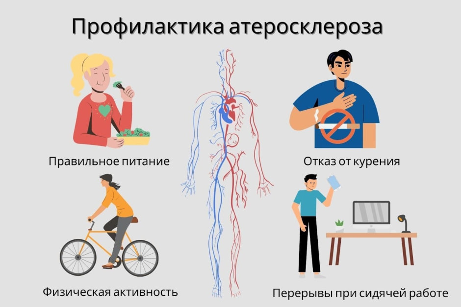 Атеросклероз 6.jpg