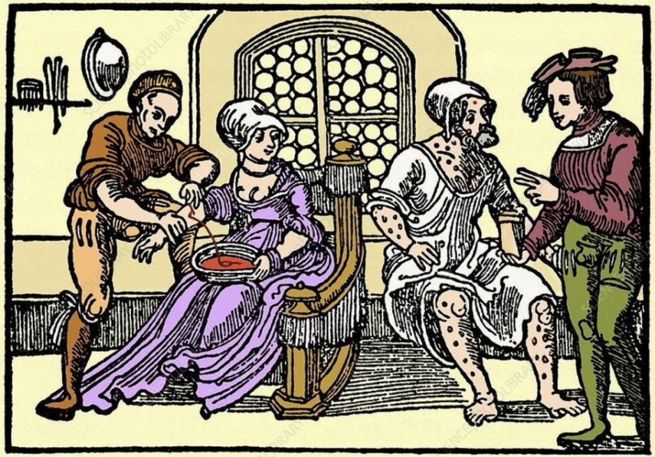 Что лечили белорусские цирюльники 3.jpg