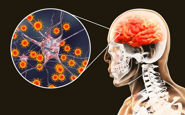 мененгит.png мененгит.png