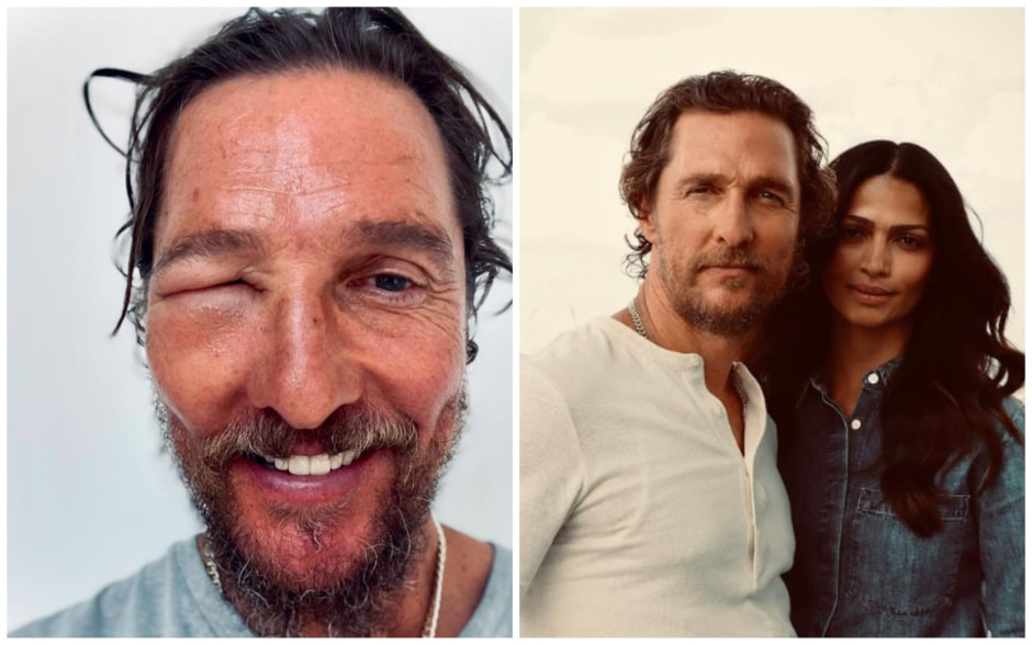 Такого Мэттью Макконахи поклонники еще не видели — что случилось.jpg