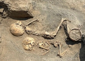 В Узбекистане нашли череп ребенка с последствиями операции 4000-летней давности