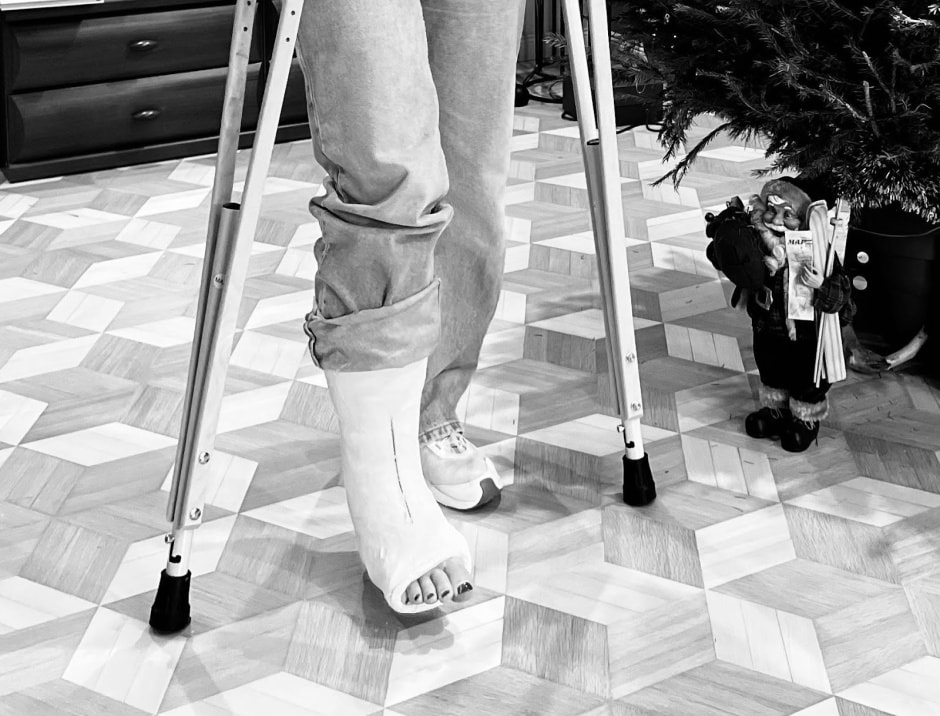 Восстановление после перелома ноги 1.jpg