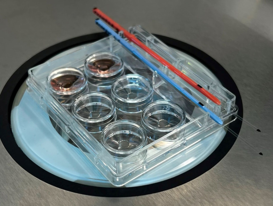 Заморозка яйцеклеток и спермы в Беларуси 6.jpg