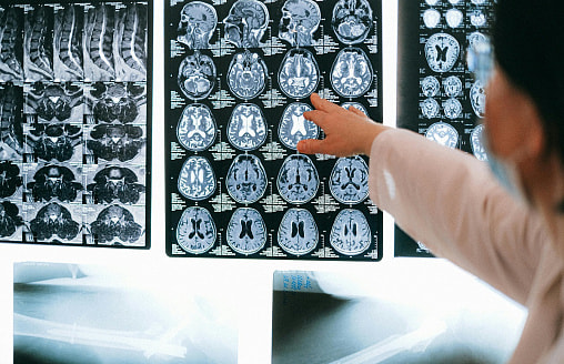 Ученые обнаружили белок, способный омолаживать стареющие клетки мозга