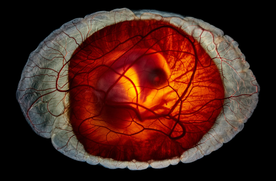 Курица или яйцо, Беркли, Калифорния